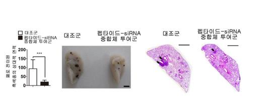 연구진이 개발한 dNP2펩타이드-Chi3l1siRNA 중합체를 동물 모델의 비강을 통해 투여한 결과, 흑색종의 폐 조직으로의 전이가 현격하게 감소한 것이 확인됐다. 자료=한국연구재단 제공
