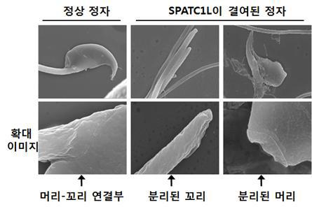 주사전자현미경으로 관찰한정상 정자와 SPATC1L이 결여된 비정상 정자의 비교. PATC1L이 결여된 정자에서 머리-꼬리 연결부분이 분리됐다. 자료=한국연구재단 제공
