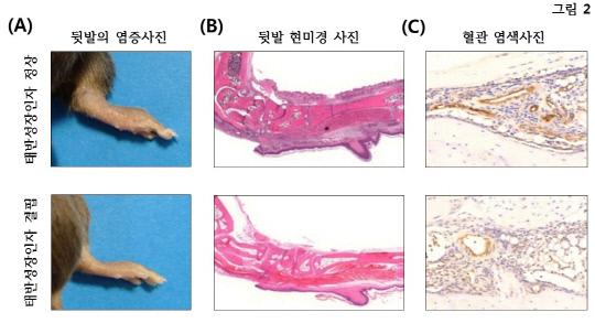 [그림 2] 태반성장인자 수치에 따른 생쥐 뒷발의 염증 정도.
생체 내에 태반성장인자가 부족한 경우 관절에 염증이 줄어고 혈관의 생성도 함께 감소됨을 확인할 수 있다. 그림=한국연구재단 제공
