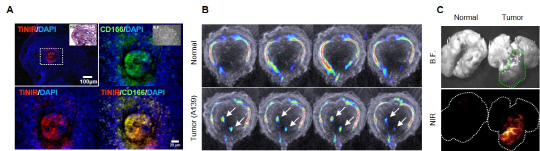 [그림 2] 타이니어를 통한 종양근원세포 시각화.
종양이 유도된 생쥐의 폐에서 타이니어가 종양근원세포를 붉은 색으로 물들임을 확인할 수 있다(A). 그림=IBS 제공
