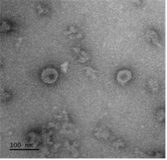 코로나19 바이러스항원(Spike)으로 구성된 바이러스유사체 투과전자현미경 (TEM) 이미지. /자료제공=국립보건연구원

